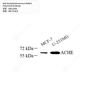 Антитела первичные, поликлональные кролика к Acetylcholinesterase крысы, мыши, человека, 50 мкл
