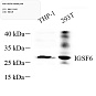 Антитела первичные, поликлональные, IGSF6, 100 мкл