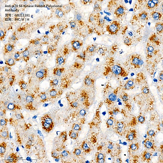 Антитела первичные, поликлональные кролика к p70 S6 Kinase человека, 50 мкл