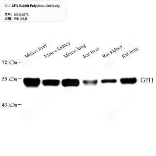 Антитела первичные, поликлональные кролика к GFI1 крысы, мыши, 50 мкл