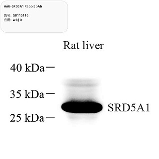 Антитела первичные, поликлональные кролика к SRD5A1 крысы, 100 мкл