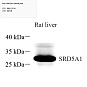 Антитела первичные, поликлональные, SRD5A1, 100 мкл