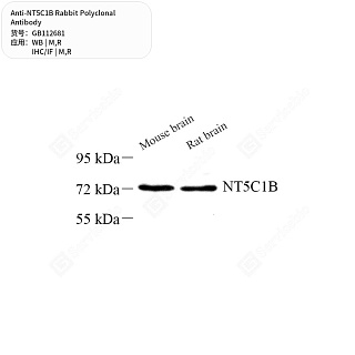 Антитела первичные, поликлональные кролика к NT5C1B крысы, мыши, 50 мкл