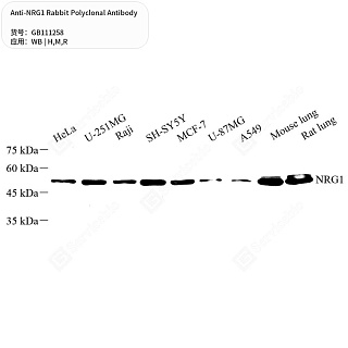 Антитела первичные, поликлональные кролика к NRG1 крысы, мыши, человека, 50 мкл