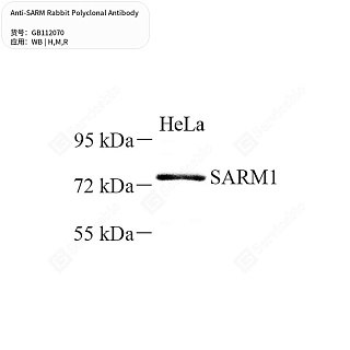 Антитела первичные, поликлональные кролика к SARM крысы, мыши, человека, 50 мкл