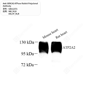 Антитела первичные, поликлональные кролика к SERCA2 ATPase крысы, мыши, 50 мкл