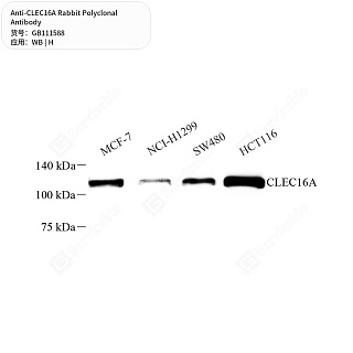 Антитела первичные, поликлональные кролика к CLEC16A человека, 50 мкл