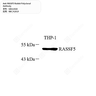 Антитела первичные, поликлональные кролика к RASSF5 крысы, мыши, человека, 50 мкл