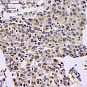 Антитела первичные, поликлональные, BRCA1, 100 мкл