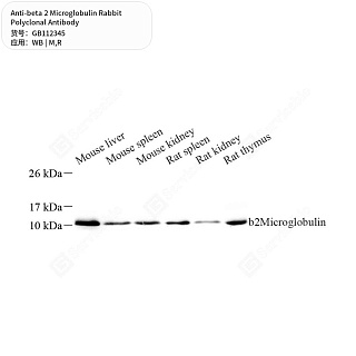 Антитела первичные, поликлональные кролика к beta 2 Microglobulin крысы, мыши, 50 мкл