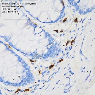 Антитела первичные, моноклональные мыши к Mast cell tryptase мыши, человека, 100 мкл