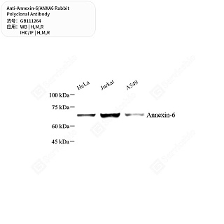 Антитела первичные, поликлональные кролика к Annexin-6/ANXA6 крысы, мыши, человека, 50 мкл