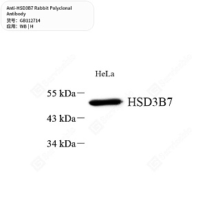 Антитела первичные, поликлональные кролика к HSD3B7 человека, 50 мкл
