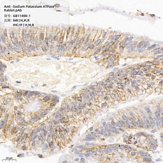 Антитела первичные, поликлональные кролика к Sodium Potassium ATPase крысы, мыши, человека, 100 мкл