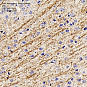 Антитела первичные, поликлональные, Myelin Basic Protein, 100 мкл