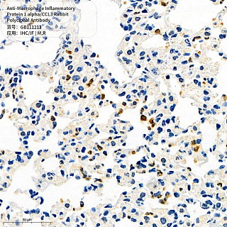Антитела первичные, пол. кролика к Macrophage Inflammatory Protein 1 alpha/CCL3 крысы, мыши, 50 мкл