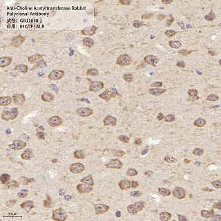 Антитела первичные, поликлональные кролика к Choline Acetyltransferase крысы, мыши, 50 мкл