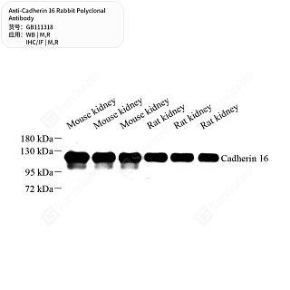 Антитела первичные, поликлональные кролика к Cadherin 16 крысы, мыши, 50 мкл