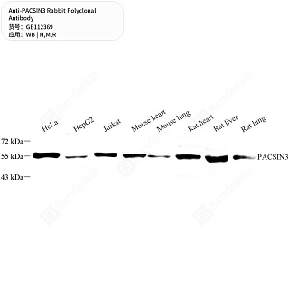 Антитела первичные, поликлональные кролика к PACSIN3 крысы, мыши, человека, 50 мкл