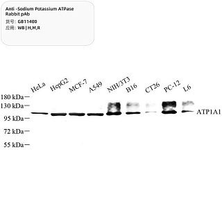 Антитела первичные, поликлональные кролика к Sodium Potassium ATPase крысы, мыши, человека, 100 мкл