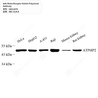 Антитела первичные, поликлональные кролика к Renin Receptor крысы, мыши, человека, 50 мкл