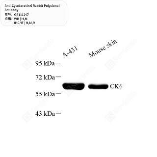 Антитела первичные, поликлональные кролика к Cytokeratin 6 крысы, мыши, человека, 50 мкл
