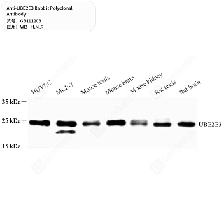 Антитела первичные, поликлональные кролика к UBE2E3 крысы, мыши, человека, 50 мкл