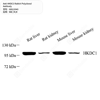 Антитела первичные, поликлональные кролика к HKDC1 крысы, мыши, 50 мкл