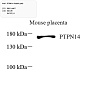Антитела первичные, поликлональные, PTPN14, 100 мкл