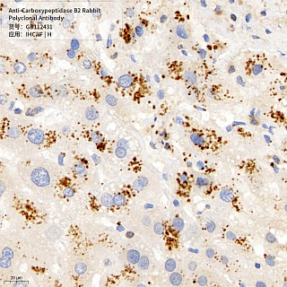 Антитела первичные, поликлональные кролика к Carboxypeptidase B2 человека, 50 мкл