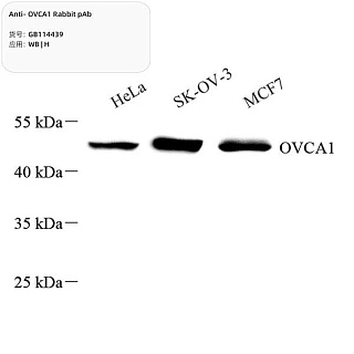 Антитела первичные, поликлональные кролика к OVCA1 человека, 100 мкл