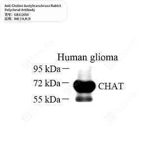 Антитела первичные, поликл. кролика к Choline Acetyltransferase крысы, мыши, человека, 50 мкл