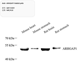 Антитела первичные, поликлональные кролика к ARHGAP1 крысы, мыши, 100 мкл