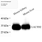 Антитела первичные, поликлональные, LACTB2, 100 мкл
