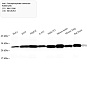 Антитела первичные, поликлональные, Triosephosphate isomerase, 100 мкл