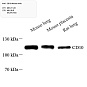 Антитела первичные, моноклональные, CD10, 100 мкл