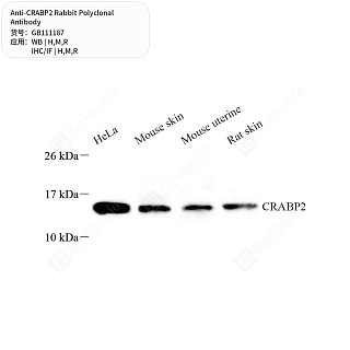 Антитела первичные, поликлональные кролика к CRABP2 крысы, мыши, человека, 50 мкл