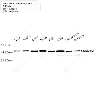 Антитела первичные, поликлональные кролика к CSNK2A1 крысы, мыши, человека, 50 мкл