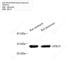 Антитела первичные, поликлональные кролика к GPCR GPR35 крысы, 50 мкл