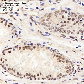 Антитела первичные, поликлональные кролика к Androgen receptor крысы, мыши, человека, 50 мкл