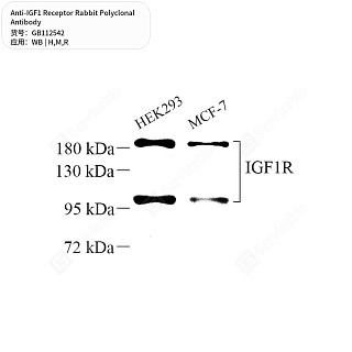 Антитела первичные, поликлональные кролика к IGF1 Receptor крысы, мыши, человека, 50 мкл