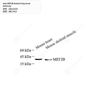 Антитела первичные, поликлональные кролика к MEF2B крысы, мыши, 50 мкл