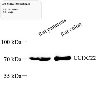 Антитела первичные, поликлональные кролика к CCDC22/JM1 крысы, 100 мкл