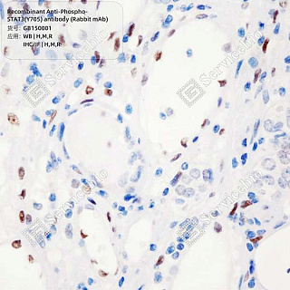 Антитела первичные, моноклональные кролика к Phospho-STAT3(Y705) крысы, мыши, человека, 100 мкл