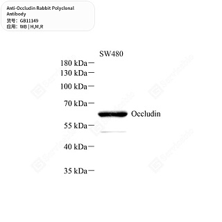 Антитела первичные, поликлональные кролика к Occludin крысы, мыши, человека, 50 мкл
