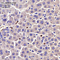 Антитела первичные, поликлональные, Telomerase reverse transcriptase, 100 мкл