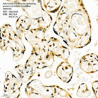 Антитела первичные, пол. крол. к Coiled-coil domain-containing protein 111 кр., мыши, чел., 50 мкл