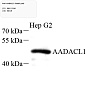 Антитела первичные, поликлональные, AADACL1, 100 мкл