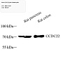 Антитела первичные, поликлональные, CCDC22/JM1, 100 мкл