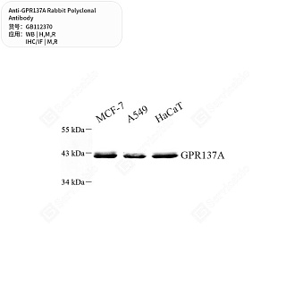 Антитела первичные, поликлональные кролика к GPR137A крысы, мыши, человека, 50 мкл